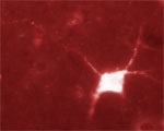 VRL-1 | Vanilloid receptor-like protein 1 in the group Antibodies Human Cell Biology / Neuroscience / Neurodegenerative diseases / Alzheimer's disease at Agrisera AB (Antibodies for research) (AS13 2690)